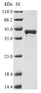 (Tris-Glycine gel) Discontinuous SDS-PAGE (reduced) with 5% enrichment gel and 15% separation gel.