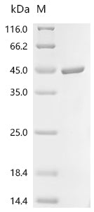 (Tris-Glycine gel) Discontinuous SDS-PAGE (reduced) with 5% enrichment gel and 15% separation gel.