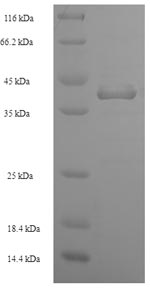Recombinant Staphylococcus aureus Enterotoxin type D (entD) – Figure 1 of 1