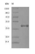 (Tris-Glycine gel) Discontinuous SDS-PAGE (reduced) with 5% enrichment gel and 15% separation gel.