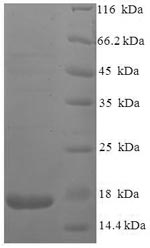 Recombinant Human immunodeficiency virus type 2 subtype A Protein Vpx (vpx) – Figure 1 of 1