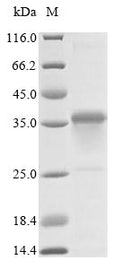 (Tris-Glycine gel) Discontinuous SDS-PAGE (reduced) with 5% enrichment gel and 15% separation gel.