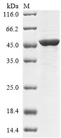 (Tris-Glycine gel) Discontinuous SDS-PAGE (reduced) with 5% enrichment gel and 15% separation gel.