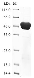 (Tris-Glycine gel) Discontinuous SDS-PAGE (reduced) with 5% enrichment gel and 15% separation gel.