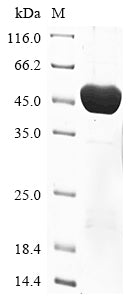 (Tris-Glycine gel) Discontinuous SDS-PAGE (reduced) with 5% enrichment gel and 15% separation gel.