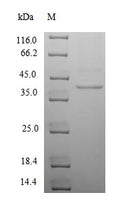 (Tris-Glycine gel) Discontinuous SDS-PAGE (reduced) with 5% enrichment gel and 15% separation gel.
