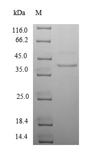 (Tris-Glycine gel) Discontinuous SDS-PAGE (reduced) with 5% enrichment gel and 15% separation gel.