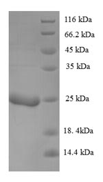 (Tris-Glycine gel) Discontinuous SDS-PAGE (reduced) with 5% enrichment gel and 15% separation gel.