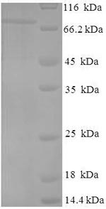 Recombinant Influenza A virus Nucleoprotein (NP) – Figure 1 of 1