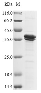 (Tris-Glycine gel) Discontinuous SDS-PAGE (reduced) with 5% enrichment gel and 15% separation gel.