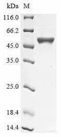 (Tris-Glycine gel) Discontinuous SDS-PAGE (reduced) with 5% enrichment gel and 15% separation gel.