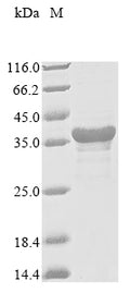(Tris-Glycine gel) Discontinuous SDS-PAGE (reduced) with 5% enrichment gel and 15% separation gel.