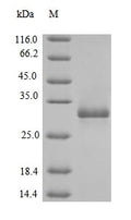 (Tris-Glycine gel) Discontinuous SDS-PAGE (reduced) with 5% enrichment gel and 15% separation gel.