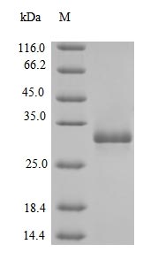 (Tris-Glycine gel) Discontinuous SDS-PAGE (reduced) with 5% enrichment gel and 15% separation gel.