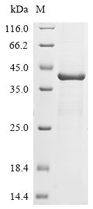 (Tris-Glycine gel) Discontinuous SDS-PAGE (reduced) with 5% enrichment gel and 15% separation gel.