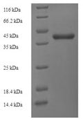 Recombinant Salmonella typhi 3-dehydroquinate dehydratase (aroD) – Figure 1 of 1