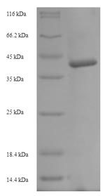 Recombinant Hordeum vulgare Cysteine proteinase EP-B 2 (EPB2) – Figure 1 of 1