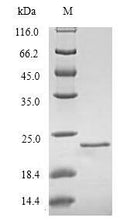 Recombinant Rat Regenerating islet-derived protein 3-beta (Reg3b) – Figure 1 of 1