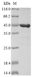 (Tris-Glycine gel) Discontinuous SDS-PAGE (reduced) with 5% enrichment gel and 15% separation gel.