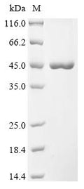 (Tris-Glycine gel) Discontinuous SDS-PAGE (reduced) with 5% enrichment gel and 15% separation gel.