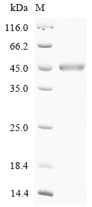 (Tris-Glycine gel) Discontinuous SDS-PAGE (reduced) with 5% enrichment gel and 15% separation gel.