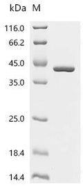 (Tris-Glycine gel) Discontinuous SDS-PAGE (reduced) with 5% enrichment gel and 15% separation gel.
