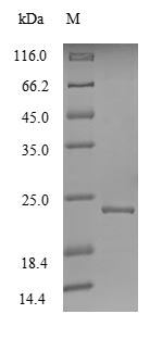 Recombinant Hepatitis E virus genotype 1 Non-structural polyprotein pORF1 (ORF1), partial – Figure 1 of 1