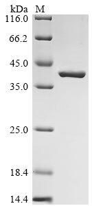(Tris-Glycine gel) Discontinuous SDS-PAGE (reduced) with 5% enrichment gel and 15% separation gel.