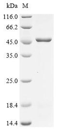 (Tris-Glycine gel) Discontinuous SDS-PAGE (reduced) with 5% enrichment gel and 15% separation gel.