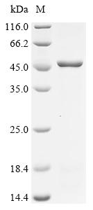 (Tris-Glycine gel) Discontinuous SDS-PAGE (reduced) with 5% enrichment gel and 15% separation gel.