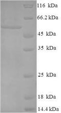 Recombinant Chlamydia trachomatis Major outer membrane porin, serovar A (ompA) – Figure 1 of 1