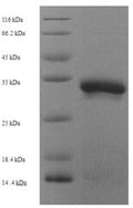 Recombinant Drosophila melanogaster Ubiquitin-conjugating enzyme E2-17KDA (UbcD6) – Figure 1 of 1