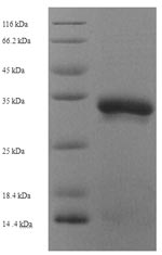 Recombinant Drosophila melanogaster Ubiquitin-conjugating enzyme E2-17KDA (UbcD6) – Figure 1 of 1