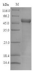 Recombinant Escherichia coli CFA/I fimbrial subunit E (cfaE) – Figure 1 of 1