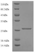 Recombinant Mouse Murinoglobulin-1 (Mug1), partial – Figure 1 of 1