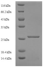 Recombinant Mouse Murinoglobulin-1 (Mug1), partial – Figure 1 of 1