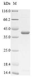 (Tris-Glycine gel) Discontinuous SDS-PAGE (reduced) with 5% enrichment gel and 15% separation gel.