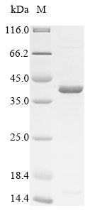 (Tris-Glycine gel) Discontinuous SDS-PAGE (reduced) with 5% enrichment gel and 15% separation gel.
