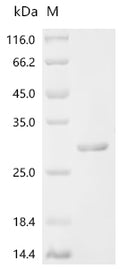 (Tris-Glycine gel) Discontinuous SDS-PAGE (reduced) with 5% enrichment gel and 15% separation gel.