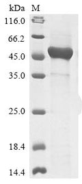 (Tris-Glycine gel) Discontinuous SDS-PAGE (reduced) with 5% enrichment gel and 15% separation gel.