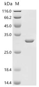 (Tris-Glycine gel) Discontinuous SDS-PAGE (reduced) with 5% enrichment gel and 15% separation gel.