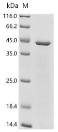 (Tris-Glycine gel) Discontinuous SDS-PAGE (reduced) with 5% enrichment gel and 15% separation gel.