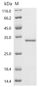 (Tris-Glycine gel) Discontinuous SDS-PAGE (reduced) with 5% enrichment gel and 15% separation gel.