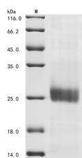 (Tris-Glycine gel) Discontinuous SDS-PAGE (reduced) with 5% enrichment gel and 15% separation gel.
