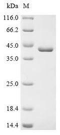 (Tris-Glycine gel) Discontinuous SDS-PAGE (reduced) with 5% enrichment gel and 15% separation gel.