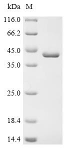 (Tris-Glycine gel) Discontinuous SDS-PAGE (reduced) with 5% enrichment gel and 15% separation gel.
