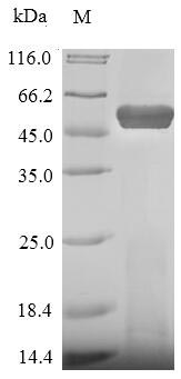 (Tris-Glycine gel) Discontinuous SDS-PAGE (reduced) with 5% enrichment gel and 15% separation gel.
