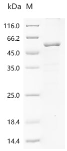 (Tris-Glycine gel) Discontinuous SDS-PAGE (reduced) with 5% enrichment gel and 15% separation gel.