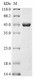 (Tris-Glycine gel) Discontinuous SDS-PAGE (reduced) with 5% enrichment gel and 15% separation gel.