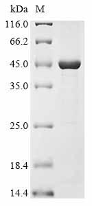 (Tris-Glycine gel) Discontinuous SDS-PAGE (reduced) with 5% enrichment gel and 15% separation gel.